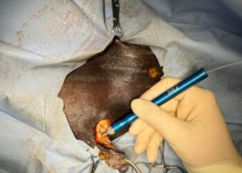 Einladung zur Fachrunde „Tumormedizin: Neue Ansätze bei Sarkoiden und Melanomen“